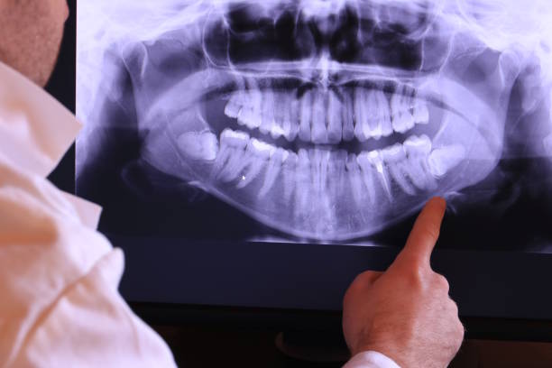 Best Emergency Gum Treatment in Dover, AR