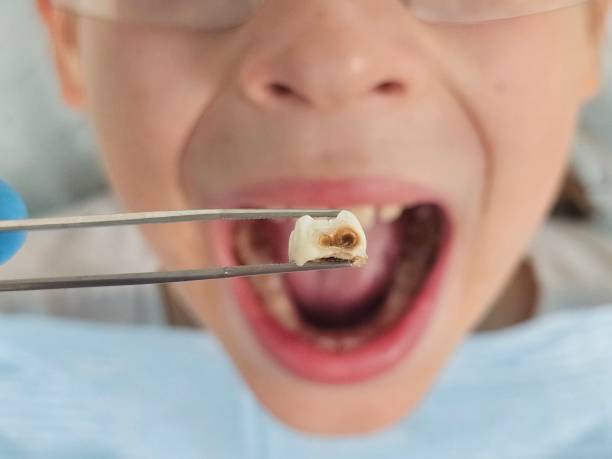 Best Same-Day Emergency Dental Services in Dover, AR